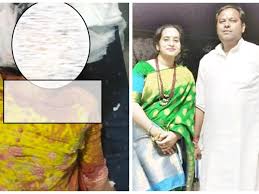 चित्रकूट: पूर्व कांग्रेस विधायक के घर नौकरानी सुसाइड केस में बड़ा खुलासा, पत्नी और प्रेमी पर केस दर्ज
